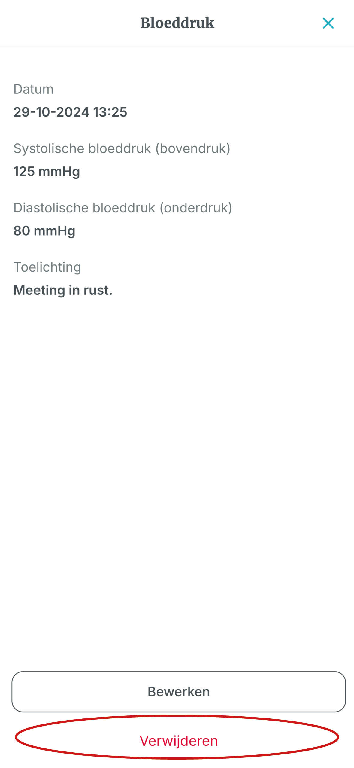 4. Klik op verwijderen.jpg