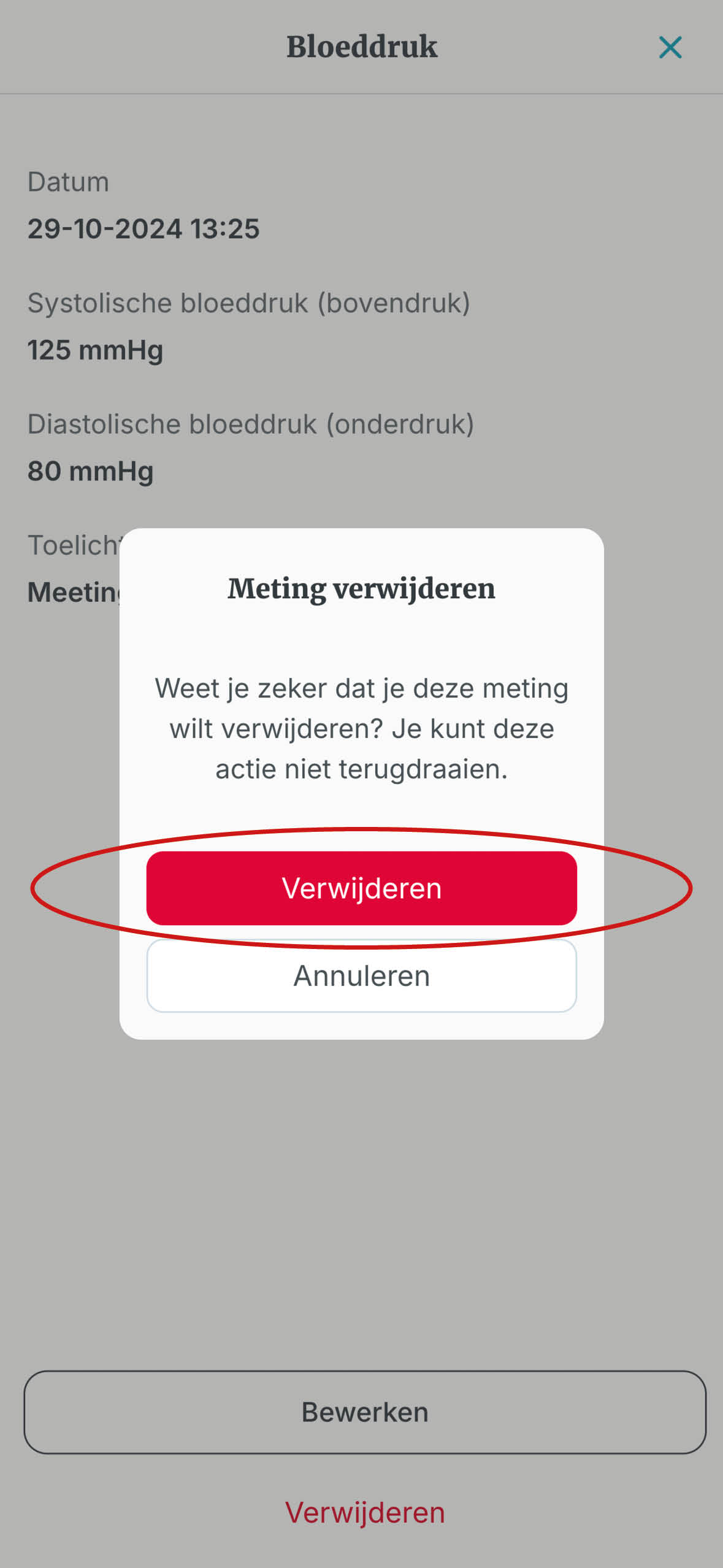 5. Klik op verwijderen.jpg