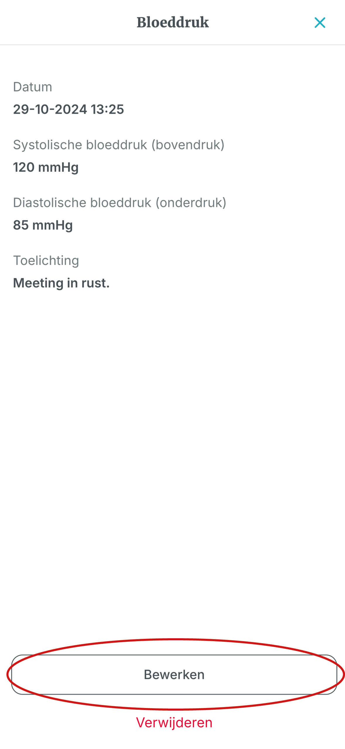 2. Kies bewerken.jpg