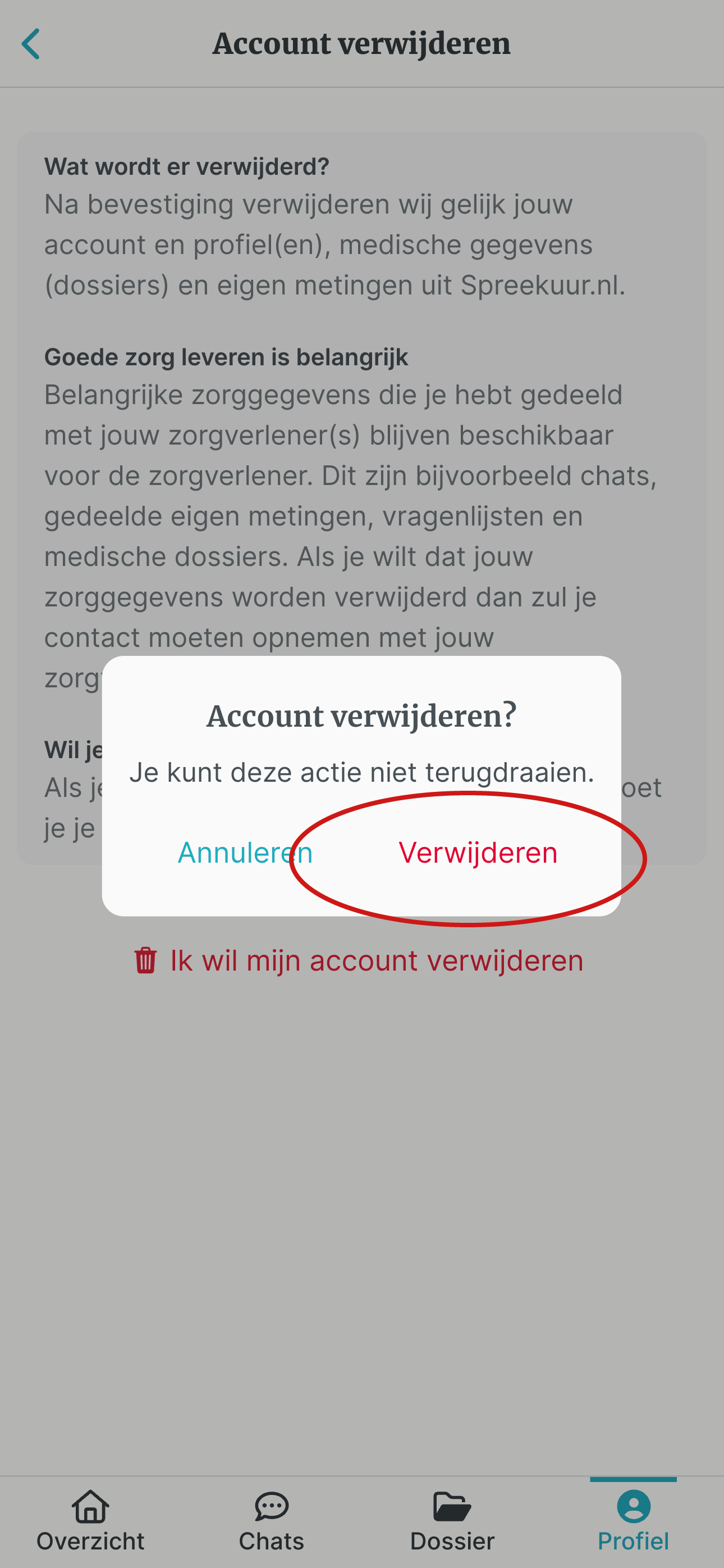 Kies verwijderen.jpg